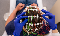 Valsts finansēti elektroencefalogrāfijas (EEG) izmeklējumi bez ilgstošas gaidīšanas rindā