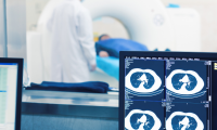 New service! Low-Dose Chest CT (computer tomography)!