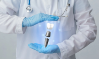 Kas jāzina par zobu implanta ievietošanu?